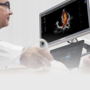 SonoScape P50 Elite Trolley Colour Doppler Ultrasound System