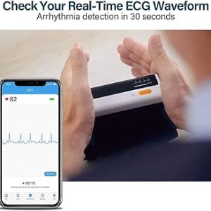 Viatom BP2 Connect Blood Pressure Monitor with ECG
