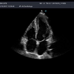 HD Phased Array Ultrasound Probe 4P A