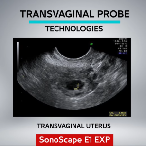 SonoScape 6V1 Endocavity Ultrasound Probe 3.0–15.0 MHz
