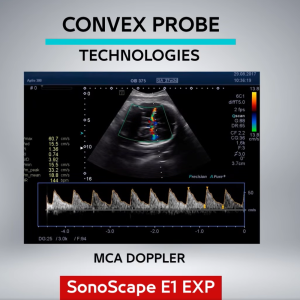 SonoScape C361 Broadband Convex Ultrasound Probe – 2–6 MHz