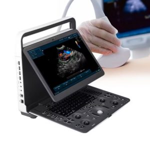 SonoScape E1 Exp Portable Colour Doppler Ultrasound System