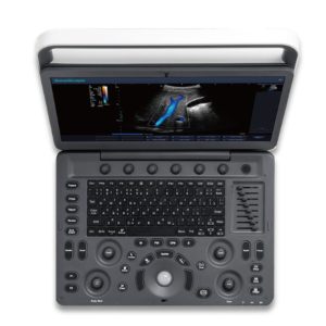 SonoScape E2 Colour Doppler Ultrasound with Cardiovascular Kit