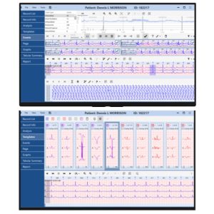 NH 301 Holter Analysis Software