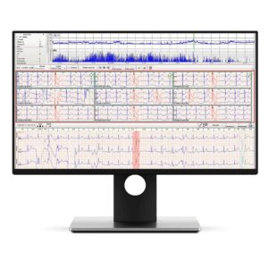 NH 301 Holter Analysis Software