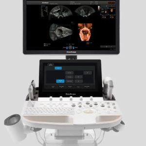 SonoScape P60 AI Colour Doppler Ultrasound System