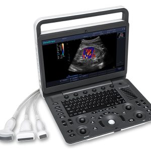 SonoScape E3 WITH 3 PROBE for SonoScape E3 Portable Colour Doppler Ultrasound System