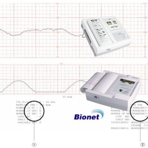 LESSA Bionet FC700 Fetal Monitor Paper Roll 214 mm x 20 m