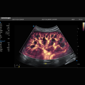 SonoScape C1 6 Single Crystal Convex Ultrasound Probe