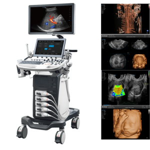 SonoScape P40 Elite AI Ultrasound System for Obstetrics and Gynaecology