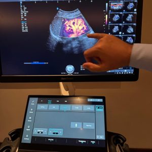 C1 6A SONOSCAPE MICROF KIDNEY for SonoScape C1 6A Ultra HD Convex Array Ultrasound Probe, 1–8 MHz